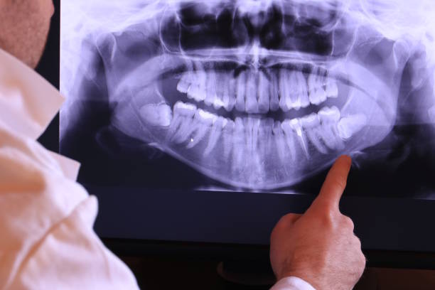 Best Urgent Care for Lost Fillings or Crowns in Wilmore, KY